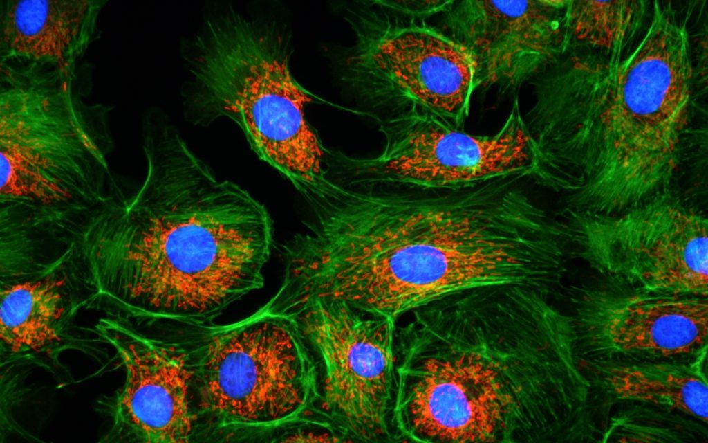 DAPI, FITC, TRITC Sample : bovine pulmonary artery endothelial cell, BPAEC Camera : AcquCAM 23GR2, Filter Set : JNO-U(B),B(B),G(B) Objective lens : UPLNAPO40X, C-mount adapter : 1X (OLYMPUS) Above three images are merged and processed using JNO-ARM