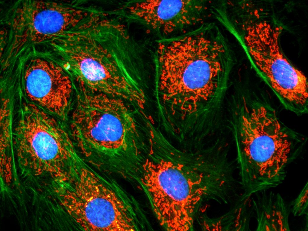 DAPI, FITC, TRITC Sample : bovine pulmonary artery endothelial cell, BPAEC Camera : AcquCAM 3G, Filter Set : JNO-U(B),B(B),G(B) Objective lens : UPLNAPO40X, C-mount adapter : 1X Above three images are merged and processed using JNO-ARM