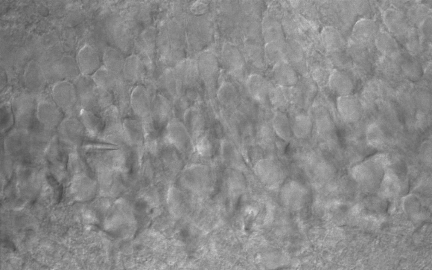 AcquCAM 23S_(Dentate gyrus Granule cell)
