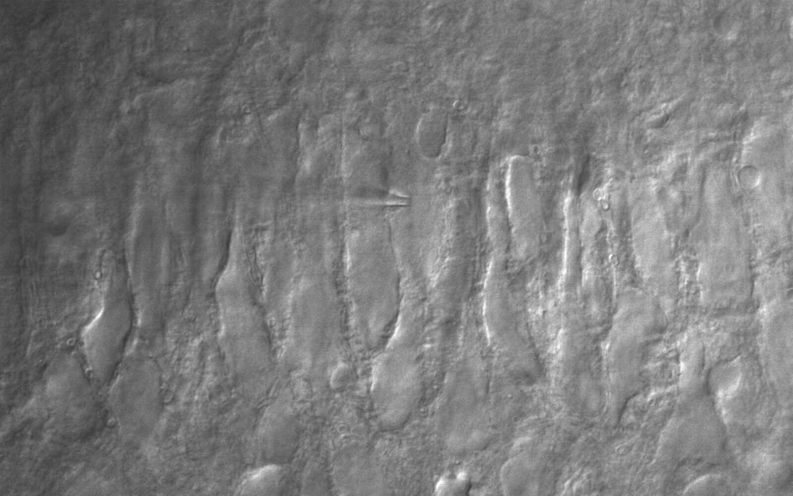 CA3 pyramidal neuron with IR DIC Image