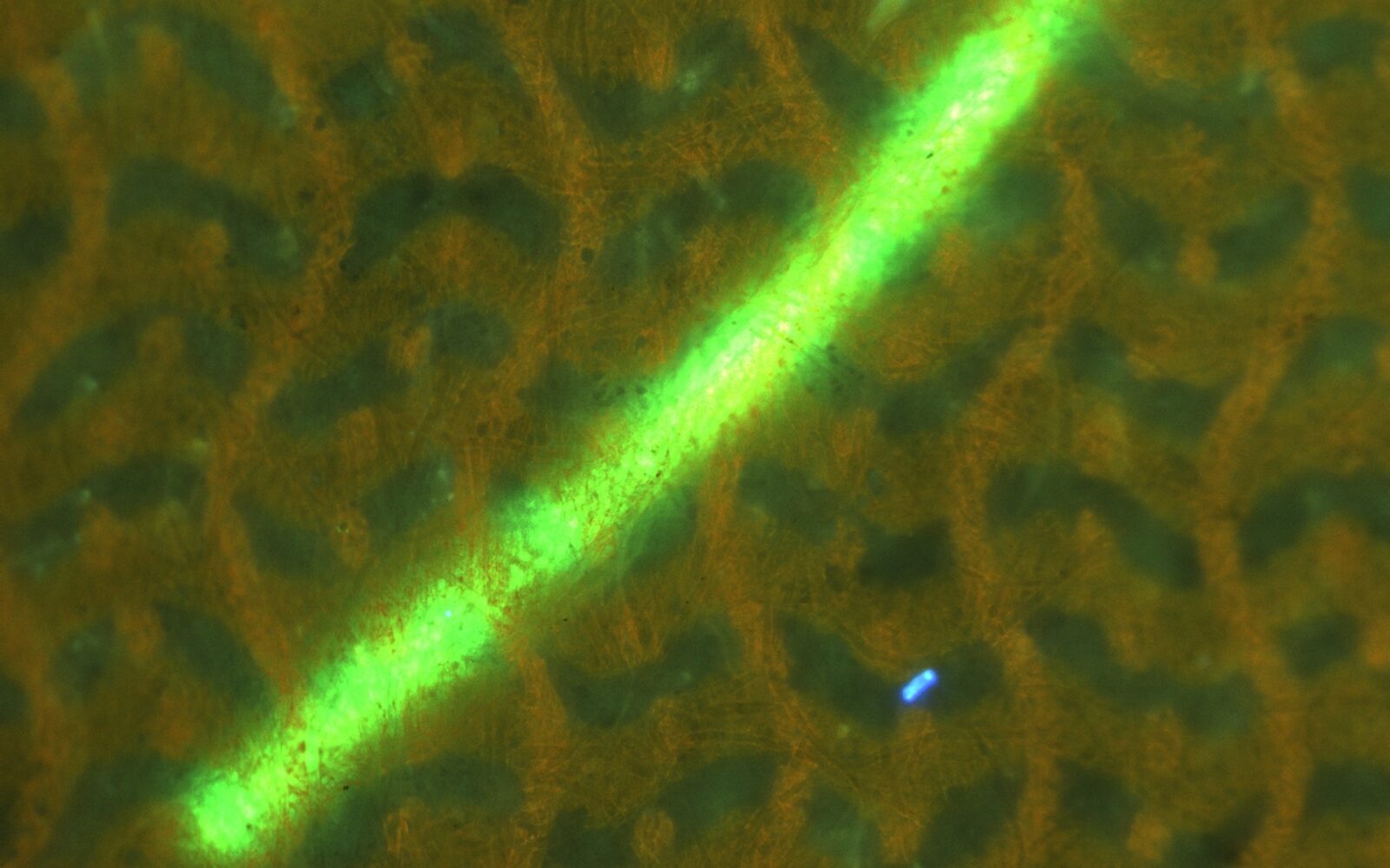 Fluorescene image(Simultaneous observation)