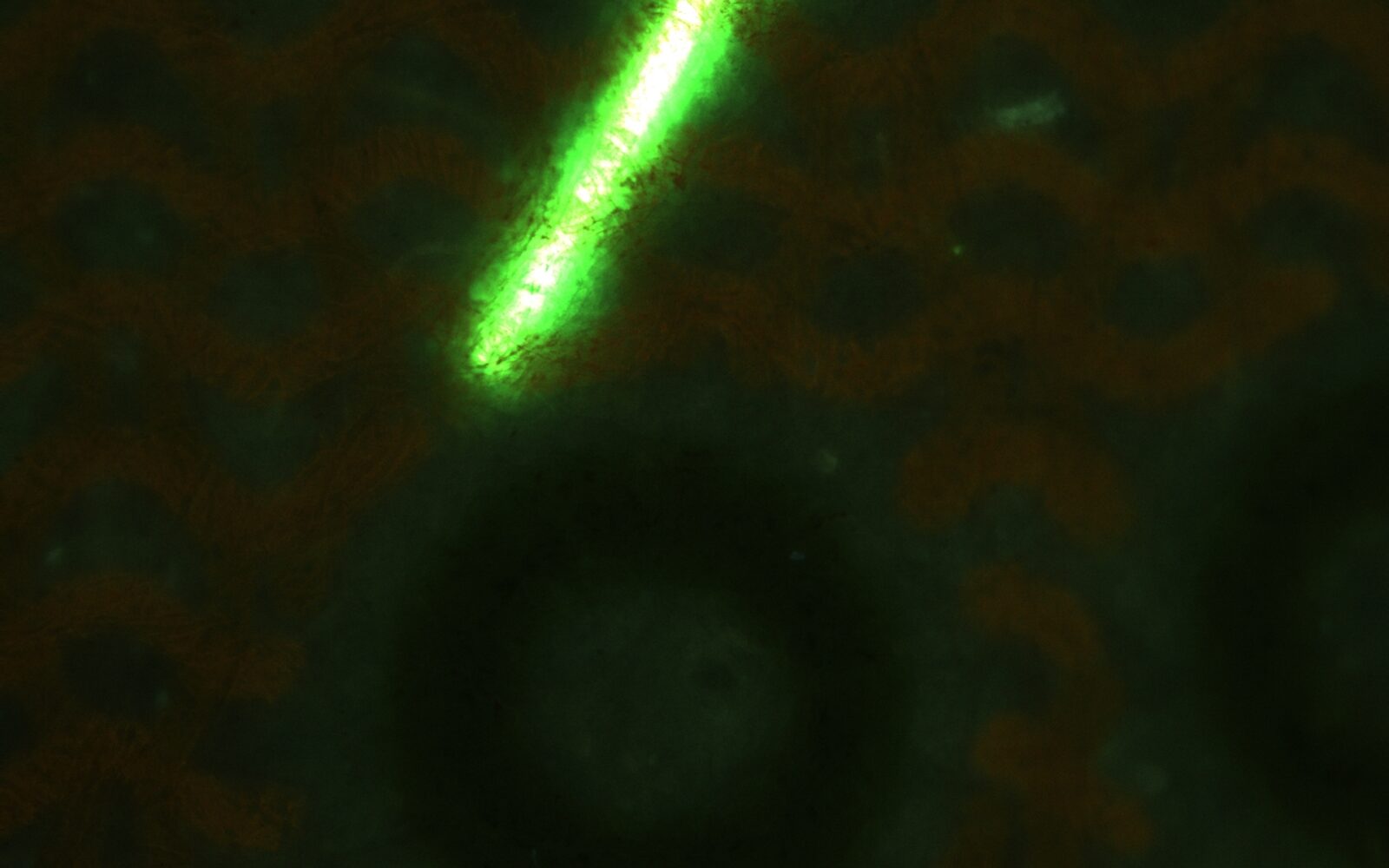Fluorescene image(Simultaneous observation)