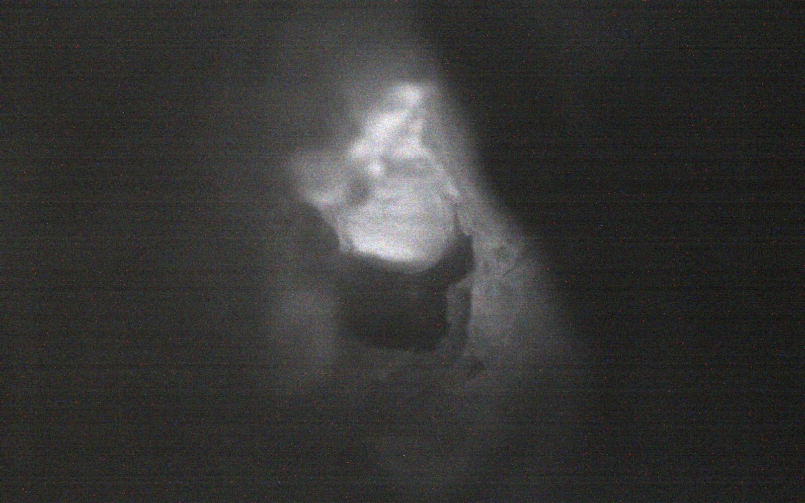 Indocyanine Green (ICG) _ Fluorescent Image