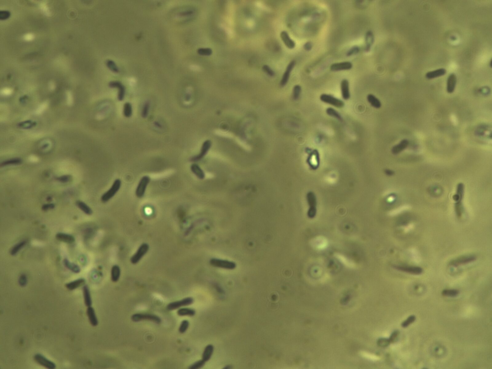 LACTOBACILLUS Inspection Microscope