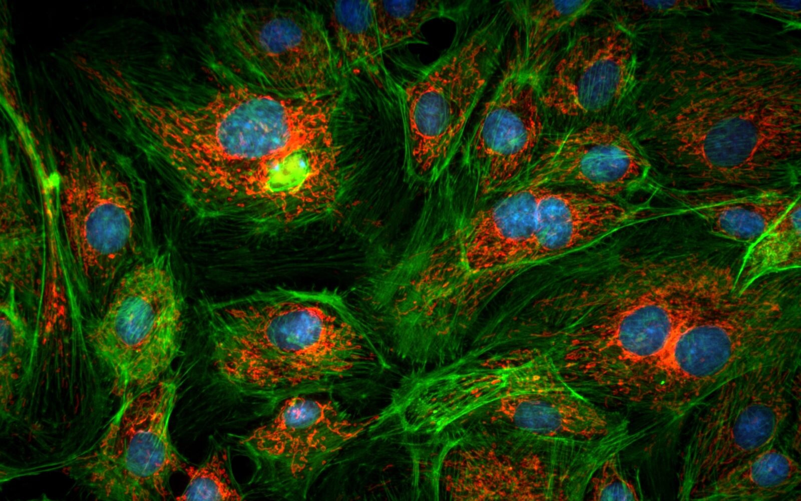 AcquCAM 23S2 Fluorescence camera DAPI, FITC, TRITC