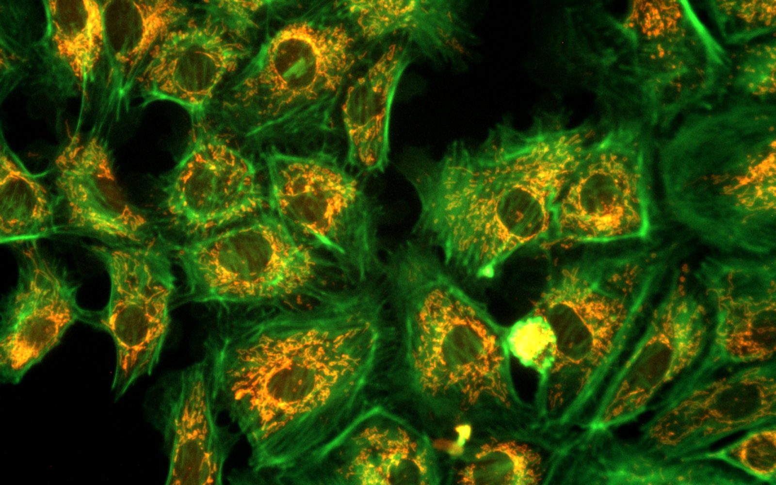 AcquCAM 23S2 Fluorescence camera DAPI, FITC, TRITC