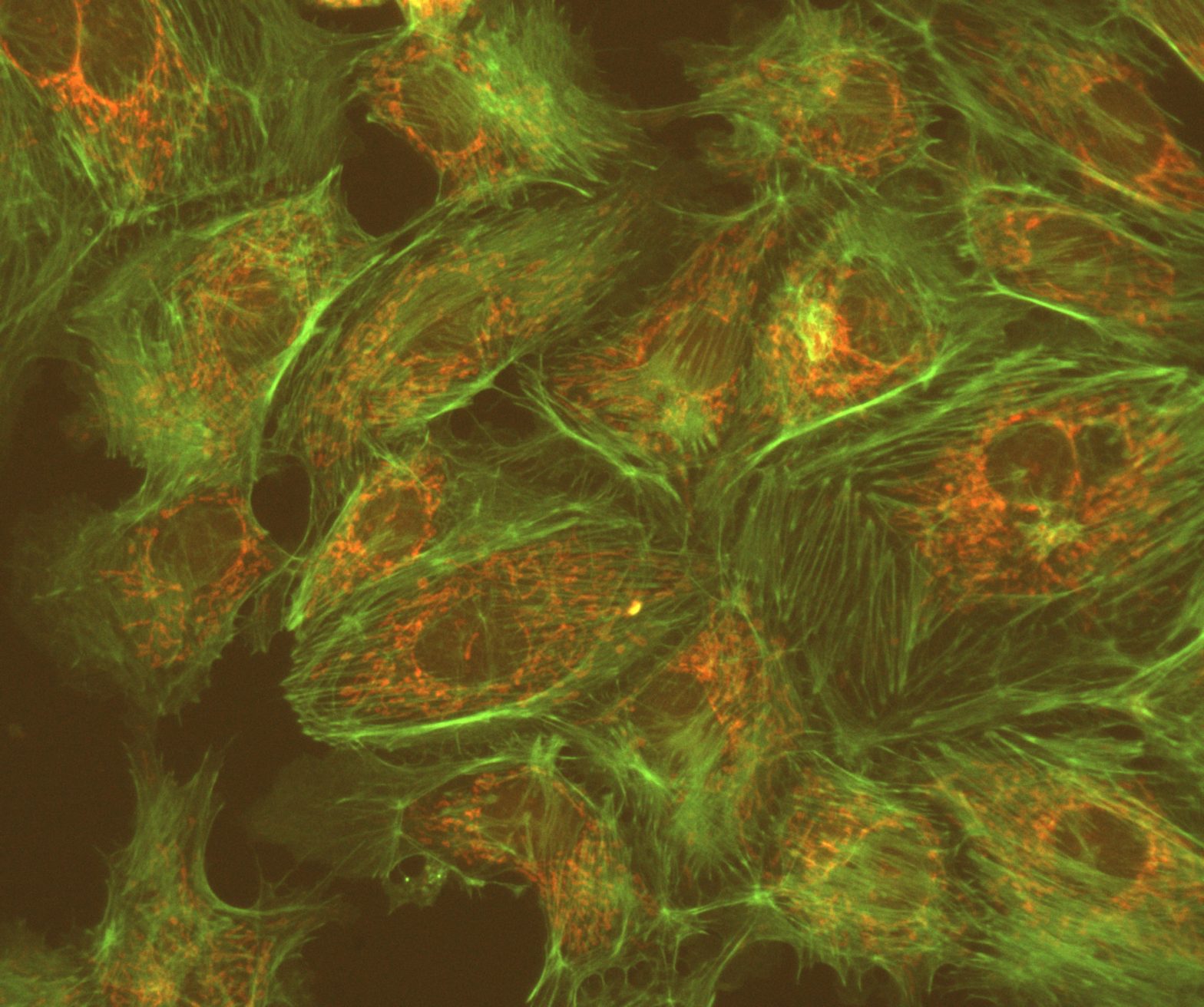 Fluorescence image taken using JNO-B(L)